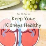 Cutting board with fresh veggies and title "Top 10 tips to keep your kidneys healthy"