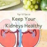 Cutting board with fresh veggies and title "Top 10 tips to keep your kidneys healthy"