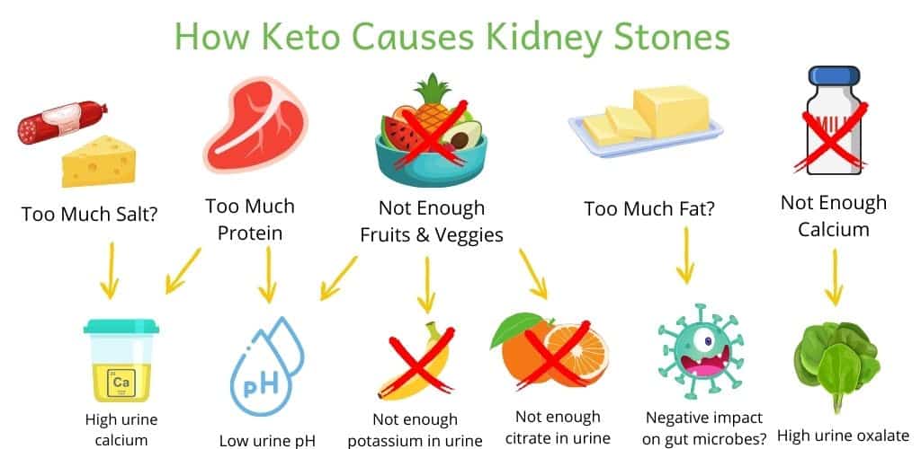 Infographic showing how components of keto diet can cause kidney stones. Too much salt (high urine calcium), too much protein (high urine calcium, low urine pH), not enough fruits and vegetables (low urine pH, low urine potassium and citrate), possibly too much fat (and possible negative impact on gut microbiome) and not enough calcium (causes high urine oxalate)