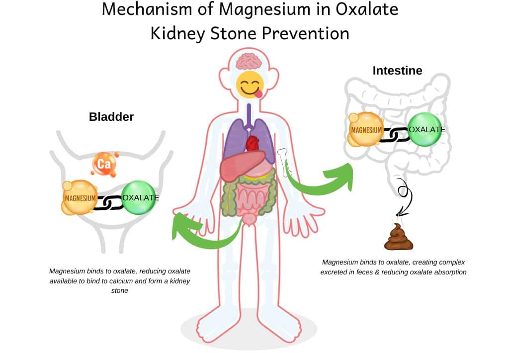 Image showing physiology of how magnesium prevents kidney stones both in the intestne and bladder
