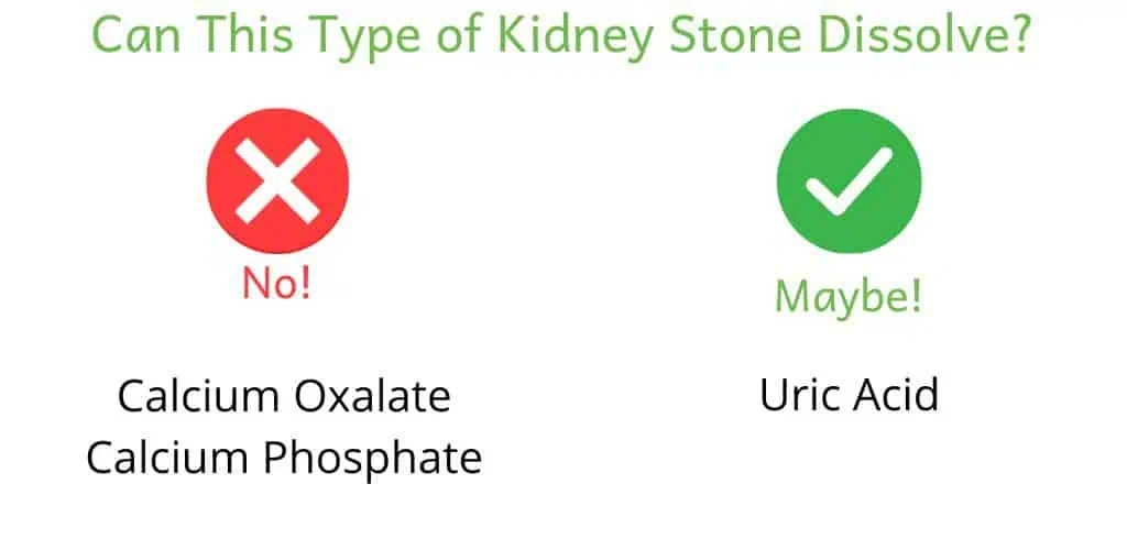 Title: Can this type of kidney stone dissolve? No: calcium oxalate & calcium phosphate. Maybe: uric acid
