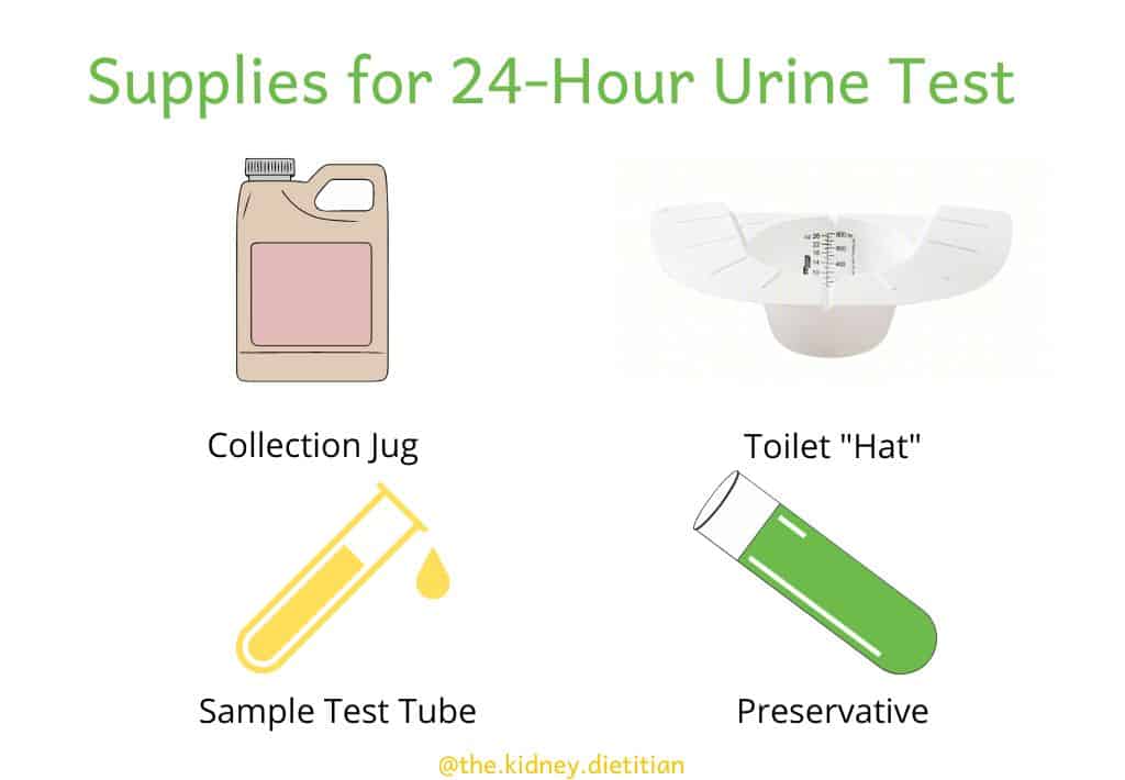 Image of supplies for a 24-hour urine test: collection jug, toilet "hat", sample test tube, preservative