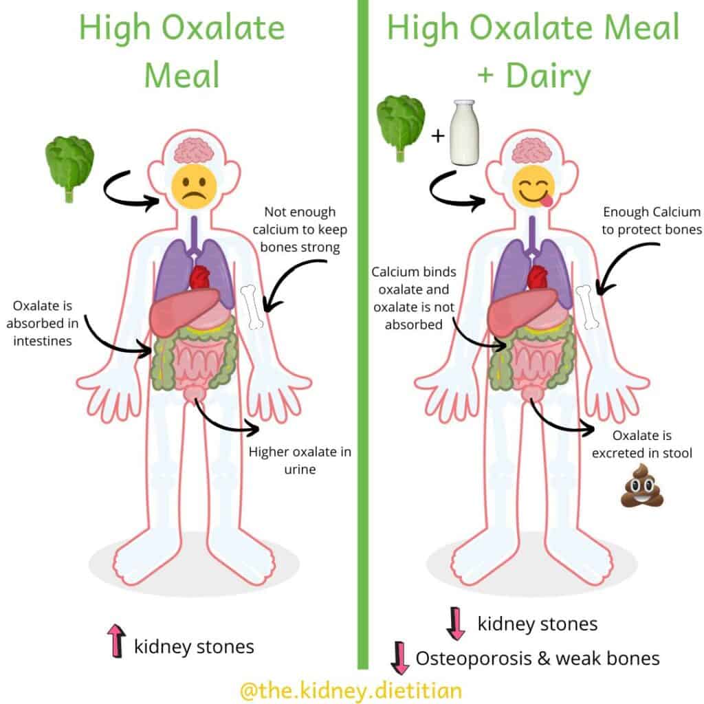 Image of cartoon human showing that when you have a high oxalate meal without calcium, oxalate is absorbed in intestines, there is not enough calcium to keep bones strong and there is a higher amount of oxalate in urine and higher risk of kidney stones. Comparatively, when a high oxalate meal is consumed with dairy, you have enough calcium to protect bones, calcium binds with oxalate in intestines and oxalate is not absorbed and is instead excreted in feces. This causes a lower risk of kidney stones and weak bones.