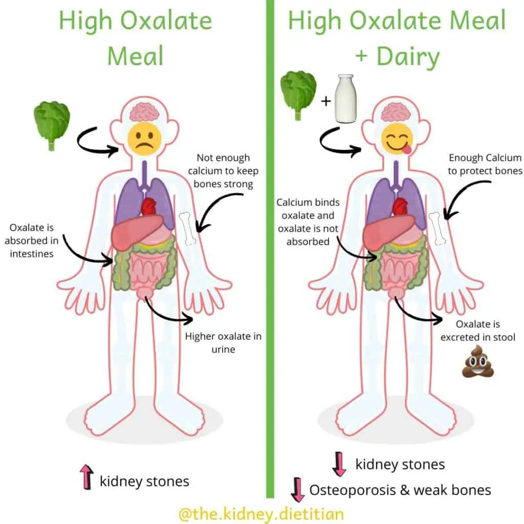 Image of cartoon human showing that when you have a high oxalate meal without calcium, oxalate is absorbed in intestines, there is not enough calcium to keep bones strong and there is a higher amount of oxalate in urine and higher risk of kidney stones. Comparatively, when a high oxalate meal is consumed with dairy, you have enough calcium to protect bones, calcium binds with oxalate in intestines and oxalate is not absorbed and is instead excreted in feces. This causes a lower risk of kidney stones and weak bones.