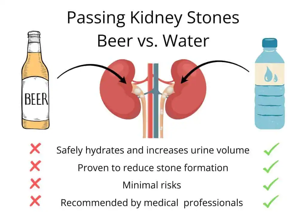 image to describe passing a kidney stone from drinking beer vs water