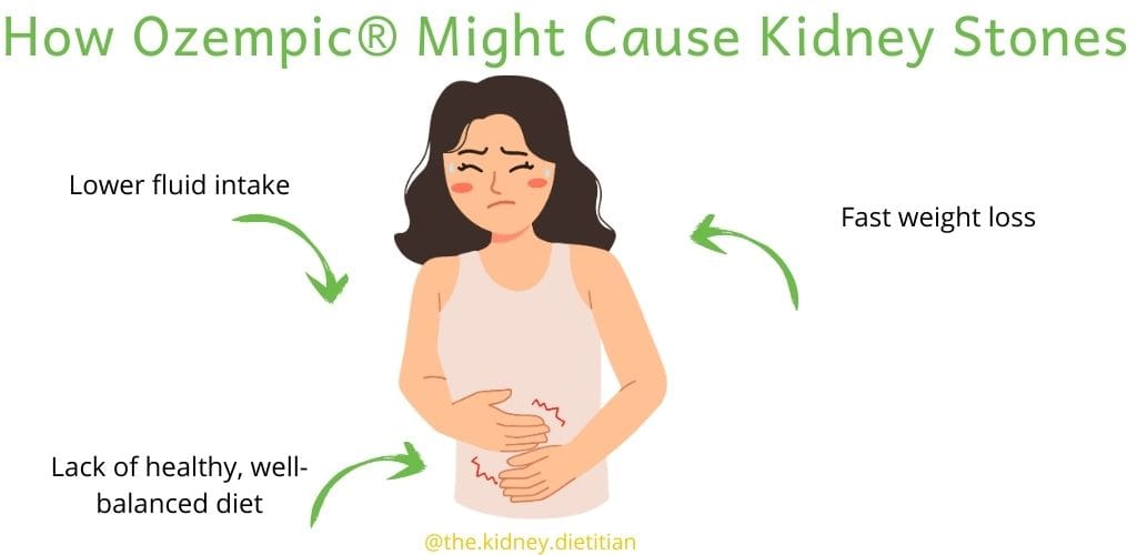 Cartoon showing how ozempic might cause kidney stones