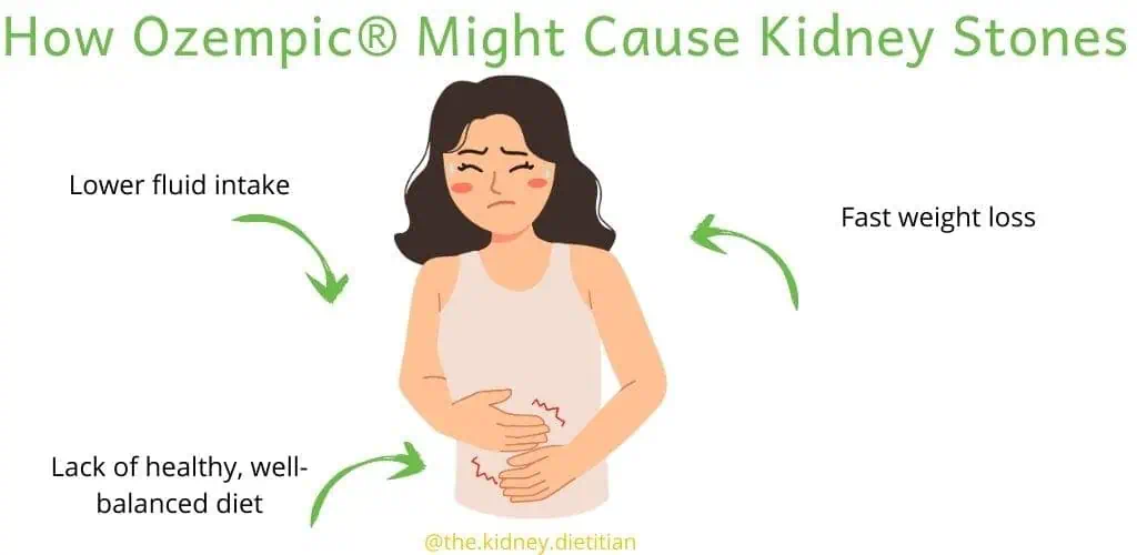 Cartoon showing how ozempic might cause kidney stones