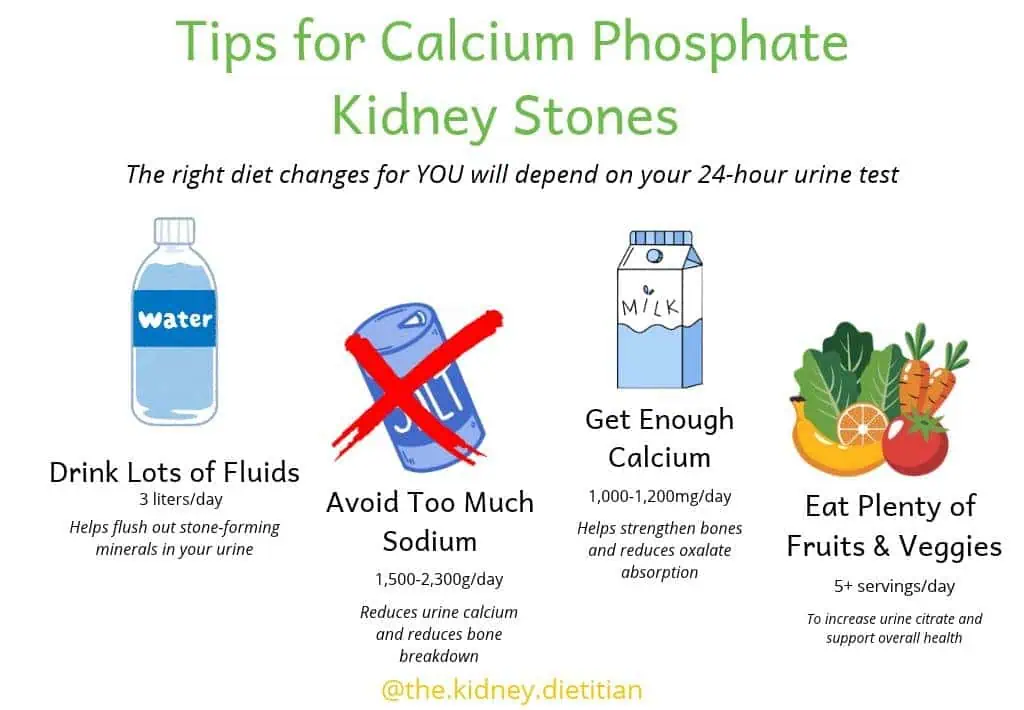 Infographic highlighting dietary strategies to prevent calcium phosphate kidney stones - drink lots of fluid, avoid too much sodium, eat enough calcium and eat plenty of fruits and veggies